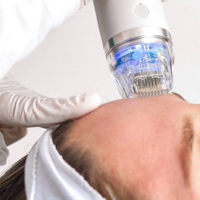 Kansas City Medspa Microneedling