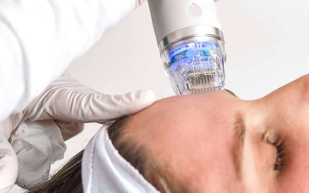 microneedling treatment kansas city