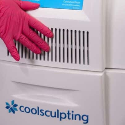Does CoolSculpting Work
