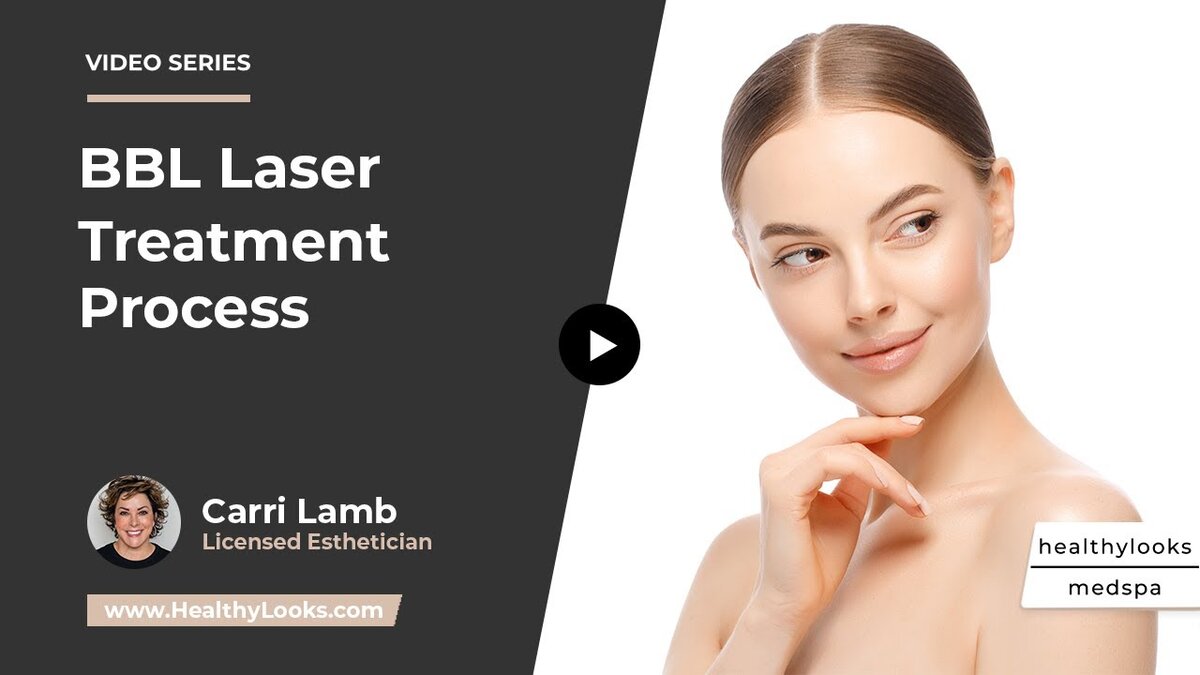 bbl laser procedure