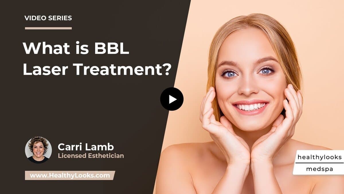 bbl laser treatment