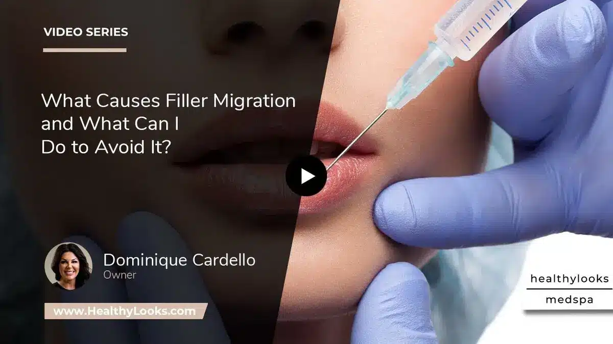 causes filler migration