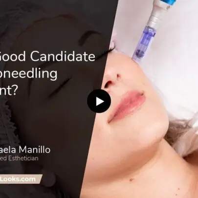 good candidate for microneedling