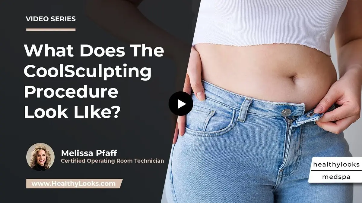 coolsculpting procedure