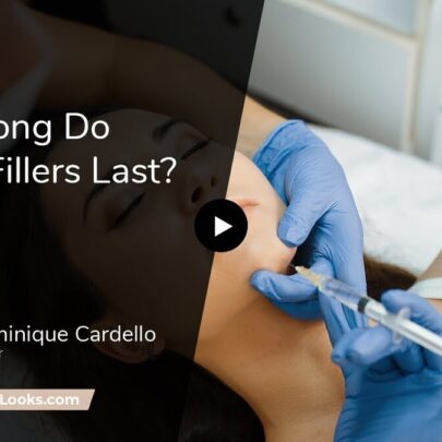 facial fillers last